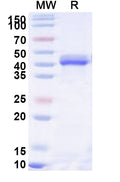 Recombinant Human CORO1C Protein, N-His