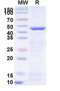Recombinant Human ATG4B Protein, N-His