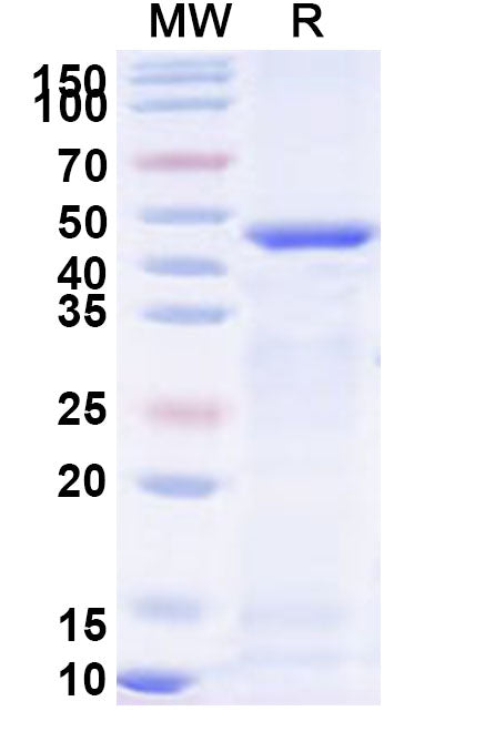 Recombinant Human ATG4B Protein, N-His