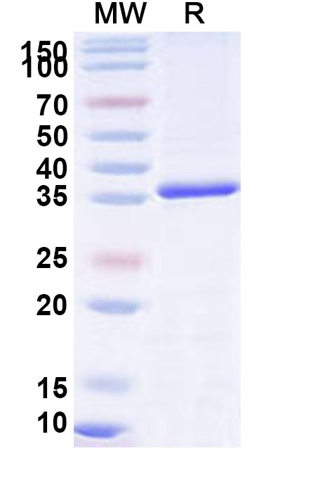 Recombinant Human VPS26A Protein, N-His