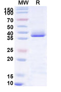 Recombinant Human MARK1 Protein, N-His