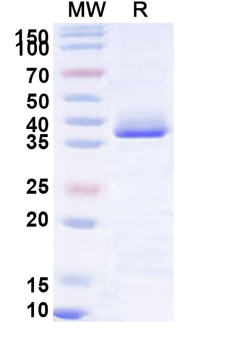 Recombinant Human MARK1 Protein, N-His