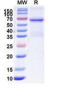 Recombinant Human AKT1 Protein, N-His