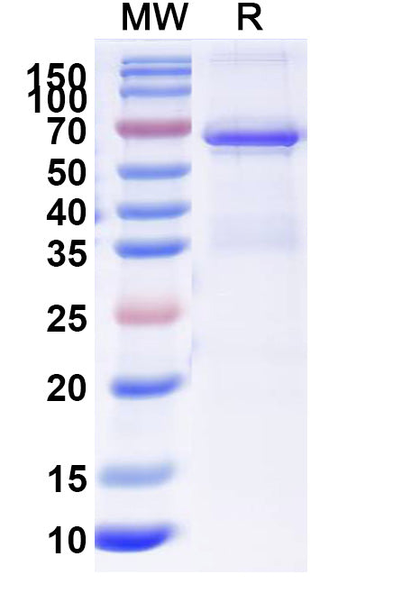 Recombinant Human AKT1 Protein, N-His