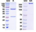 SDS-PAGE for Anti-Human BRAF/B-Raf (V600E) Antibody (SAA2068)