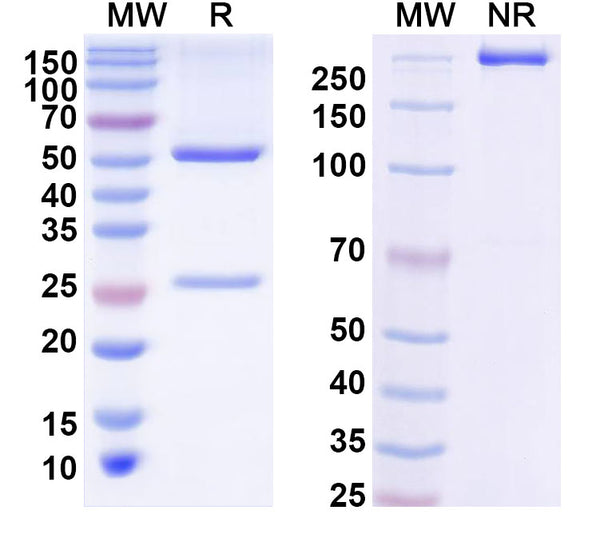 SDS-PAGE for Anti-Human BRAF/B-Raf (V600E) Antibody (SAA2068)