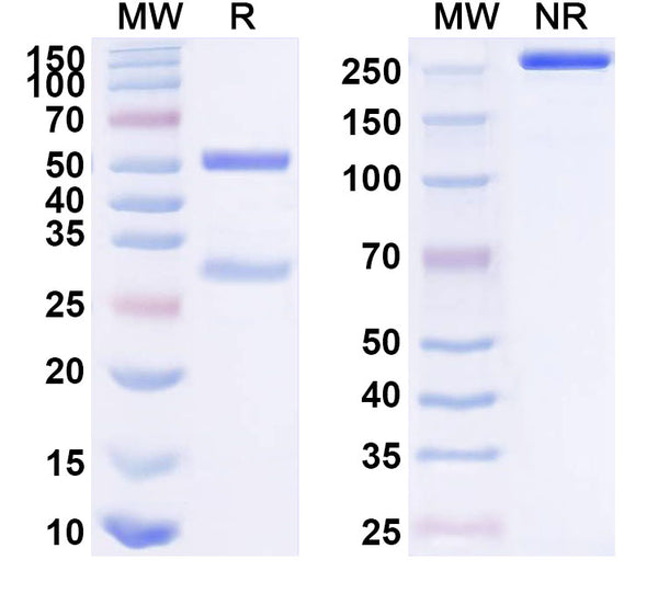 SDS-PAGE for Anti-Human IDE Antibody (SAA1582)