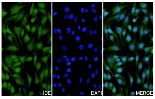 Hela cells were fixed with 4% paraformaldehyde for 20 minutes, followed by blocking with 5% goat serum for 1 hour. The cells were then incubated with a primary antibody targeting IDE (HB619014) at a concentration of 12.6 ug/ml overnight at 4°C. Afterward, the cells were incubated with a secondary antibody, Goat Anti-Rabbit IgG (Alexa Fluor-488) for 50 minutes at room temperature. The localization of IDE was visualized (shown in green), and nuclear DNA was stained with DAPI (shown in blue).