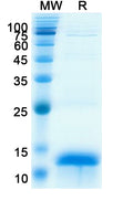 Recombinant Human CCNB1 Protein, N-His