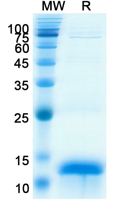Recombinant Human CCNB1 Protein, N-His