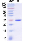 Recombinant Human CD35/CR1 Protein, N-His