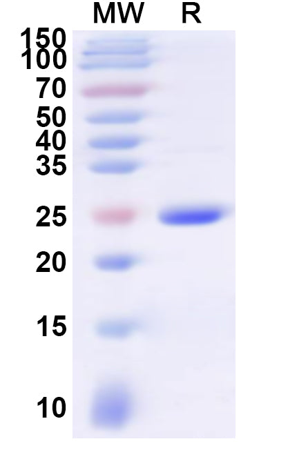Recombinant Human CD35/CR1 Protein, N-His