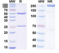 SDS-PAGE for Anti-Human SCCA Monoclonal Antibody (1A294)