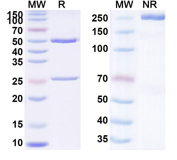SDS-PAGE for Anti-Human SCCA Monoclonal Antibody (1A294)
