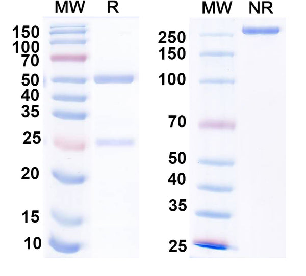 SDS-PAGE for Anti-GABA(A)R, Beta3 Antibody (N87/25)