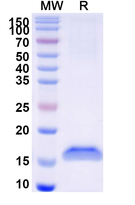 SDS-PAGE for Anti-Human CD152/CTLA4 Nanobody (SAA1104)