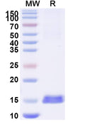 SDS-PAGE for Anti-Human CD152/CTLA4 Nanobody (SAA1054)