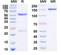 SDS-PAGE for Anti-Human CD152/CTLA4 Antibody (SAA0062)
