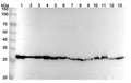 Western blot analysis was performed using anti-PAGM1 polyclonal antibody at 1ug/mL on various samples.
Lane 1: NIH3T3 cell lysate
Lane 2: Hela cell lysate
Lane 3: 293T cell lysate
Lane 4: Jurkat cell lysate
Lane 5: Lncap cell lysate
Lane 6: K562 cell lysate
Lane 7: U2OS cell lysate
Lane 8: 4T1 cell lysate
Lane 9: HepG2 cell lysate
Lane 10: Mouse liver lysate
Lane11: Mouse kidney lysate
Lane12: Rat liver lysate
Lane13: Rat kidney lysate