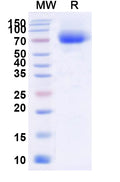 Recombinant Human CD333/FGFR3 Protein, C-His