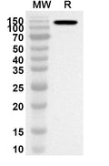 Western blot analysis was performed using anti-CD11c/ITGAX polyclonal antibody at 1ug/mL on recombinant CD11c/ITGAX (Catalog No. HB666012).