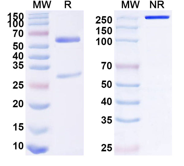 SDS-PAGE for Anti-Human LHCGR Antibody (SAA1607)