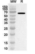 Western blot analysis was performed using anti-CPA3 polyclonal antibody at 1ug/mL on recombinant CPA3 (Catalog No. HB708012).