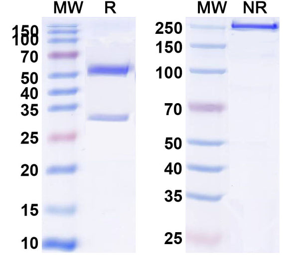SDS-PAGE for Anti-Human CD123/IL3RA Antibody (SAA0045)
