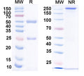 SDS-PAGE for Anti-Ankyrin-R Antibody (N388A/10)