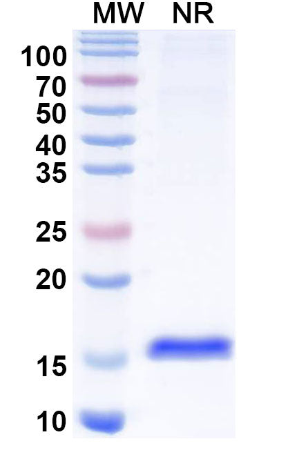 SDS-PAGE for Anti-Human CTGF/CCN2 Nanobody (SAA1211)