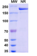 Anti-Human CTGF/CCN2 Reference Antibody (Pamrevlumab) – Figure 1 of 1