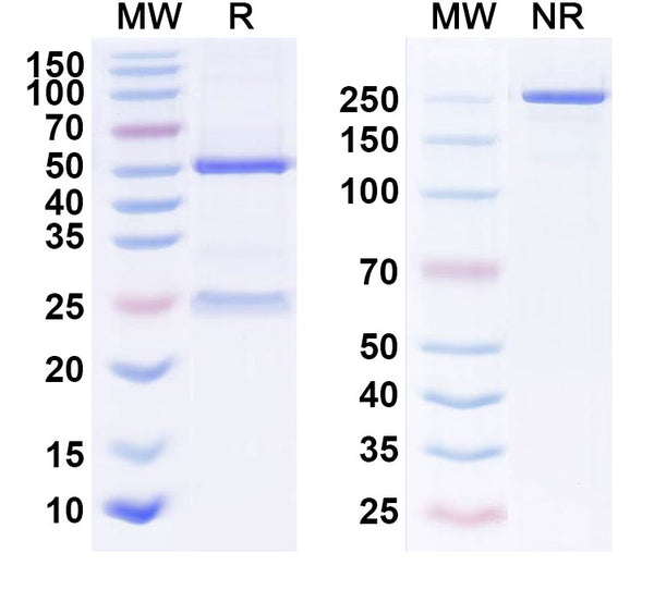 SDS-PAGE for Anti-Human CTGF/CCN2 Monoclonal Antibody (1A137)