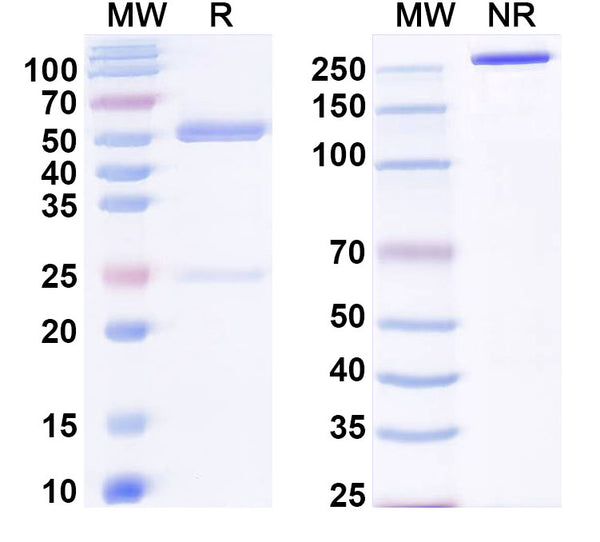 SDS-PAGE for Anti-Human SLC6A4/SERT Antibody (8B6)