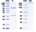 Anti-Human S100A4 Reference Antibody (AX-202) – Figure 1 of 1