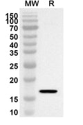 Western blot analysis was performed using anti-CRABP1 polyclonal antibody at 1ug/mL on recombinant CRABP1 (Catalog No. HB734012).
