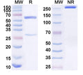 SDS-PAGE for Anti-Human TSPAN8 Antibody (SAA1592)
