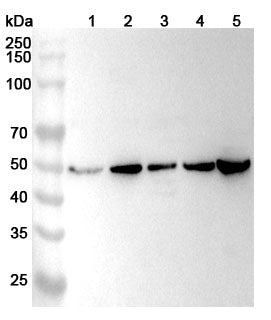 Western blot analysis was performed using anti-FECH polyclonal antibody at 1ug/mL on various samples.
Lane 1: HepG2 cell lysate
Lane 2: K562 cell lysate
Lane 3: HT-29 cell lysate
Lane 4: Jurkat cell lysate
Lane 5: Mouse brain lysate