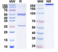Anti-Human OSM/Oncostatin-M Reference Antibody (GSK 2330811) – Figure 1 of 1