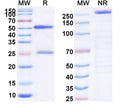 Anti-Human IL-12/IL-23 p40 Reference Antibody (Briakinumab) – Figure 1 of 1
