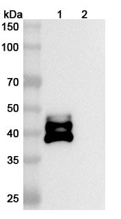 Anti-Human IL-12/IL-23 p40 Reference Antibody (Ebdarokimab) – Figure 1 of 3
