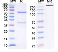 SDS-PAGE for Anti-Human CCL1/I-309 Antibody (SAA0526)