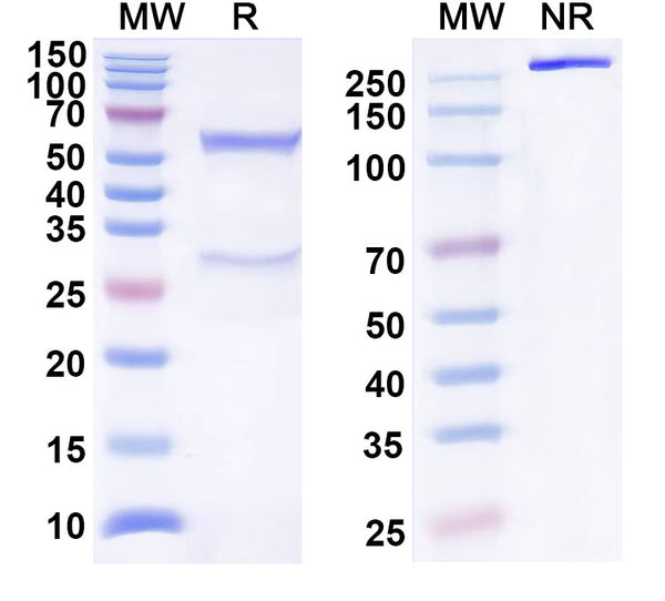 SDS-PAGE for Anti-Human CCL1/I-309 Antibody (SAA0526)