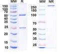 SDS-PAGE for Anti-GABA(A)R, Alpha5 Antibody (N415/24)
