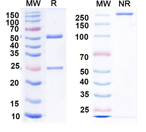 SDS-PAGE for Anti-GABA(A)R, Alpha5 Antibody (N415/31)