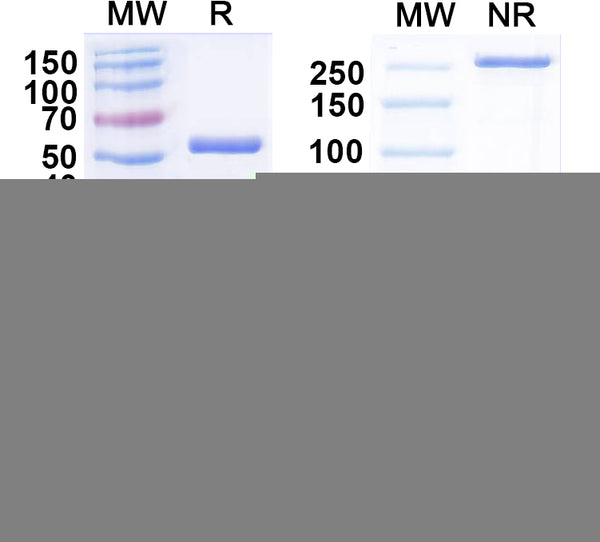 SDS-PAGE for Anti-GABA(A)R, Alpha5 Antibody (N415/66)