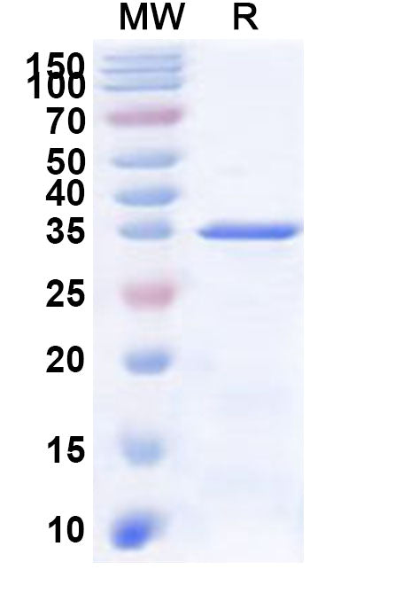 Recombinant Human GLB1 Protein, N-His