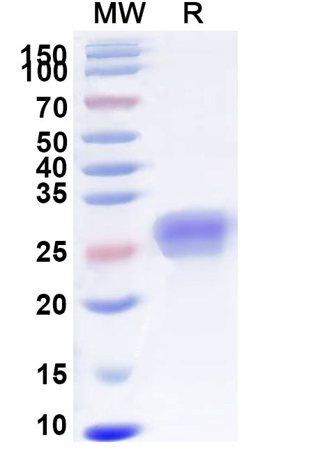 Recombinant Human CD40/TNFRSF5 Protein, C-His