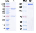 Anti-Human CD40/TNFRSF5 Reference Antibody (2141-V11) – Figure 1 of 1