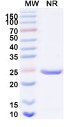Recombinant Human ACHE Protein, N-His