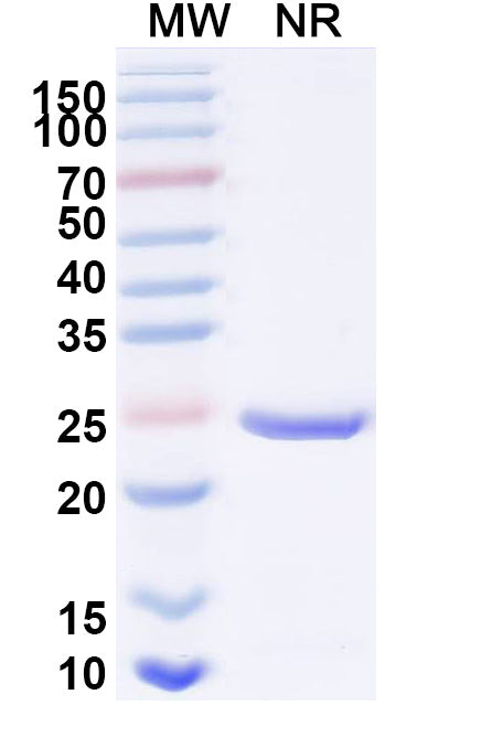 Recombinant Human ACHE Protein, N-His